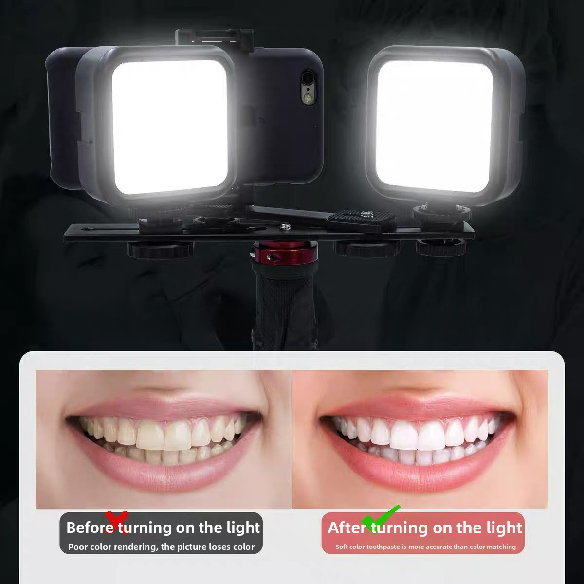 Bluetooth搭載歯科用写真撮影ライト 口腔内写真照明  - Photography Mobile Lighting のレビューと価格