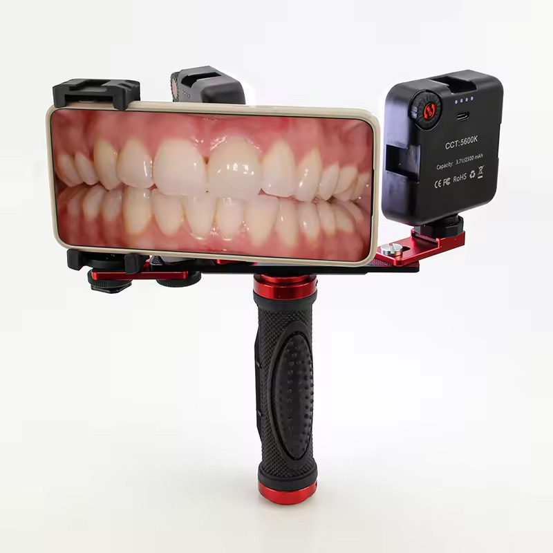 歯科用モバイル写真撮影LEDライト 口腔内写真・ビデオ用フラ - Photography Mobile Lighting のレビューと価格
